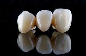 Three-unit dental bridge on dark reflective surface