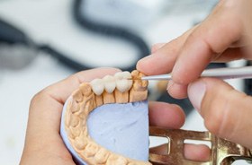 Lab technician working on dental bridge