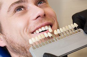 Man's smile compared with tooth color chart