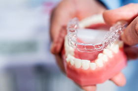 Clear aligner being placed on tooth model
