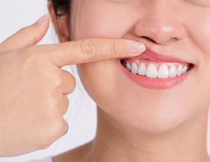 Woman showing her gums