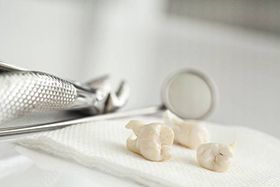 Extracted teeth
