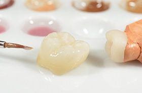 Dental crown prior to placement