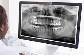 Dental x-rays on computer screen